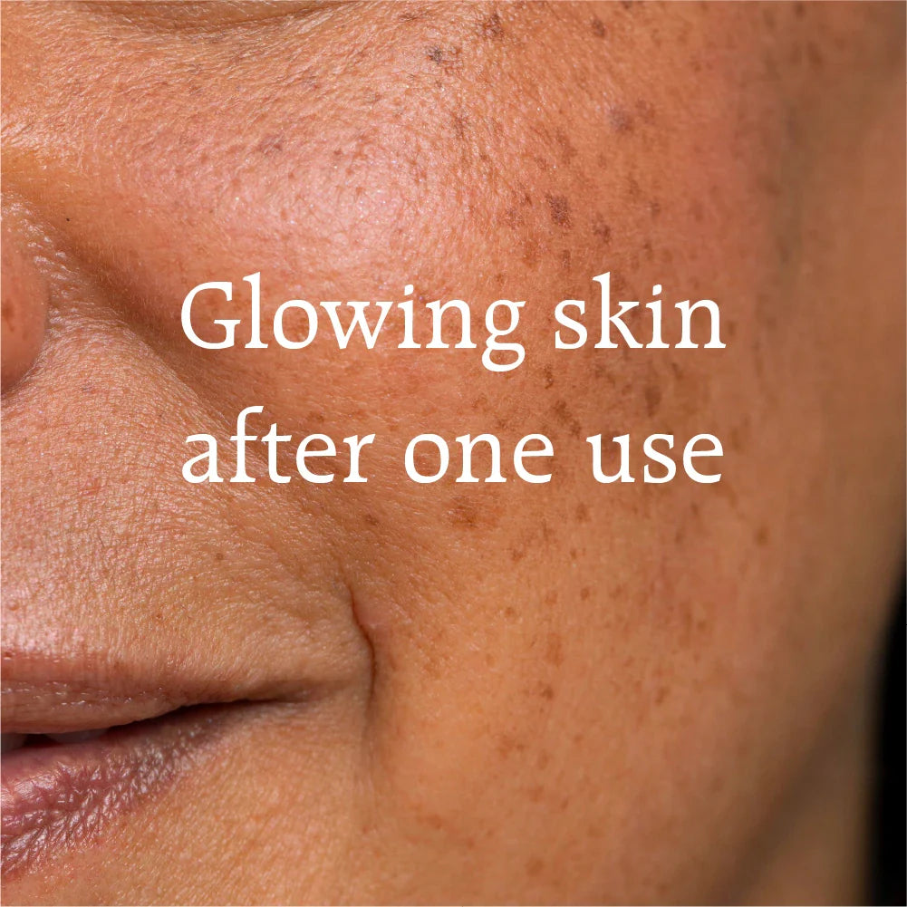 500 Roses Facial Elixir results by Perfect Potion