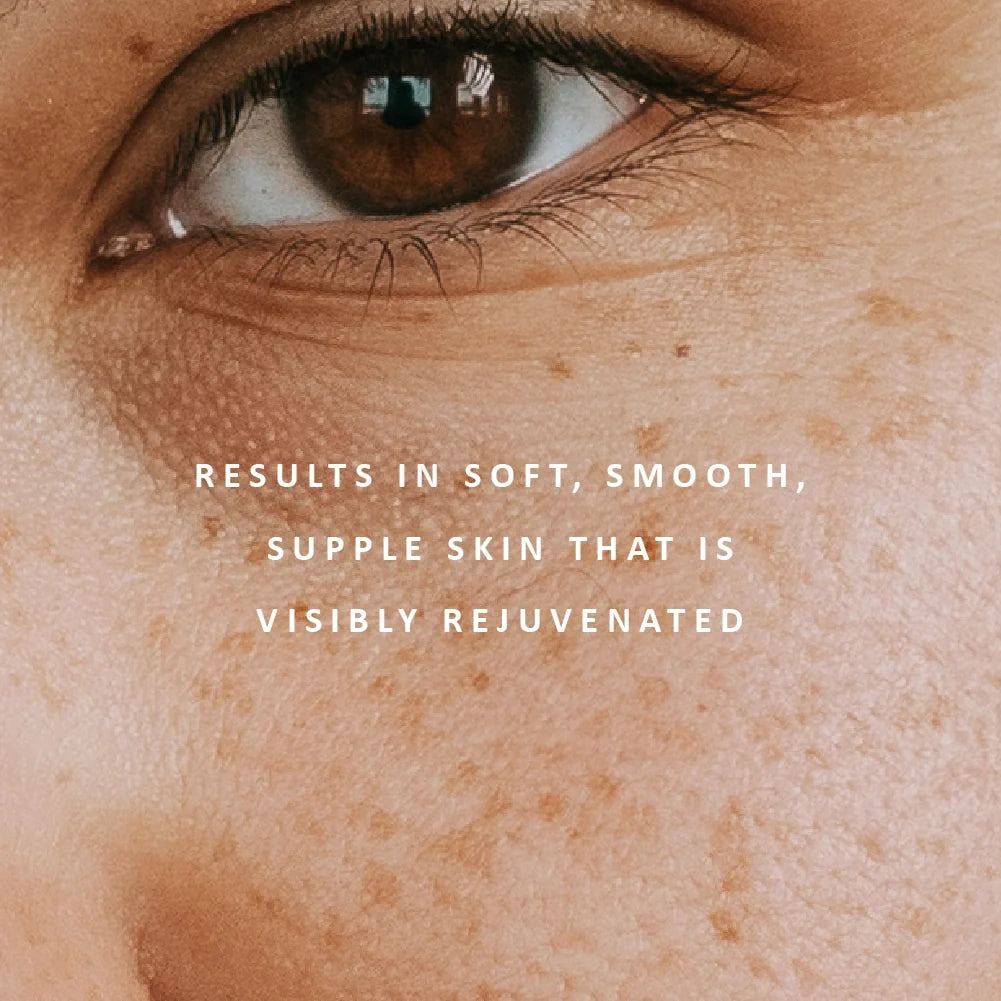 Replenish Ultra-Rich Moisture Cream results by Perfect Potion