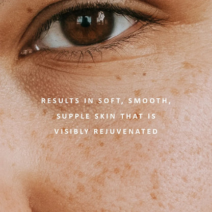 Replenish Ultra-Rich Moisture Cream results by Perfect Potion